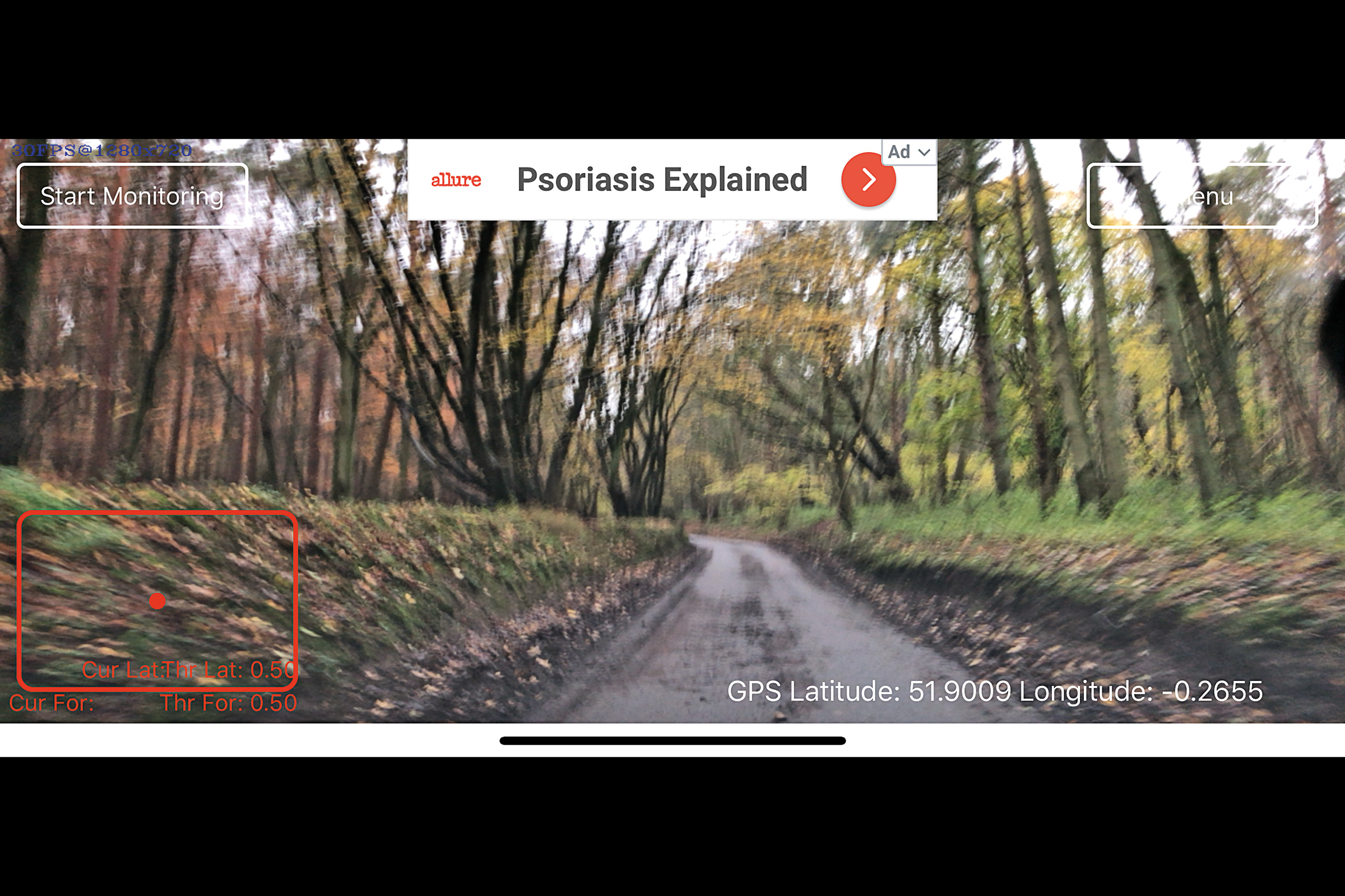 Smart Dashcam Pro